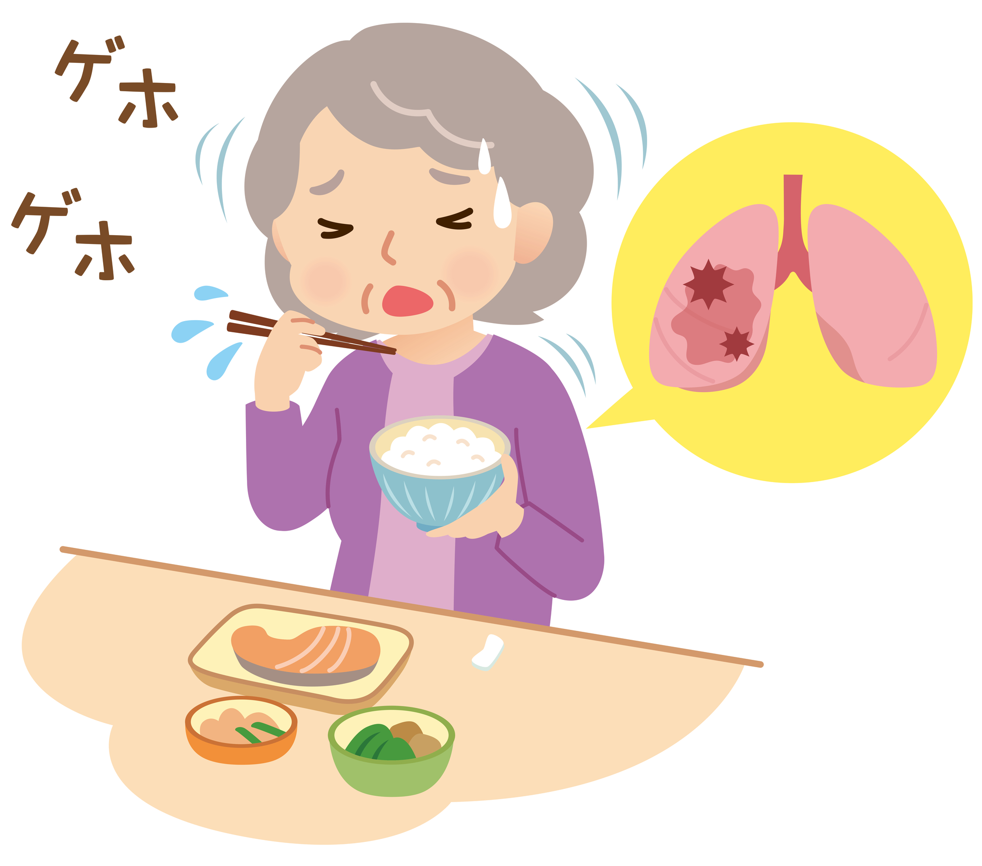 誤嚥性肺イメージ