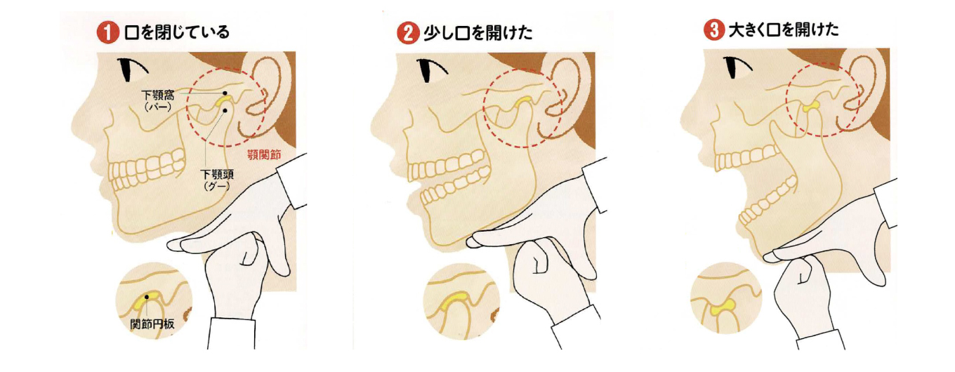 グーとパーで顎関節の動きを再現！